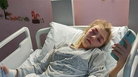  تكاد تفقد بصرها بسبب صبغ حاجبيها ورموشها