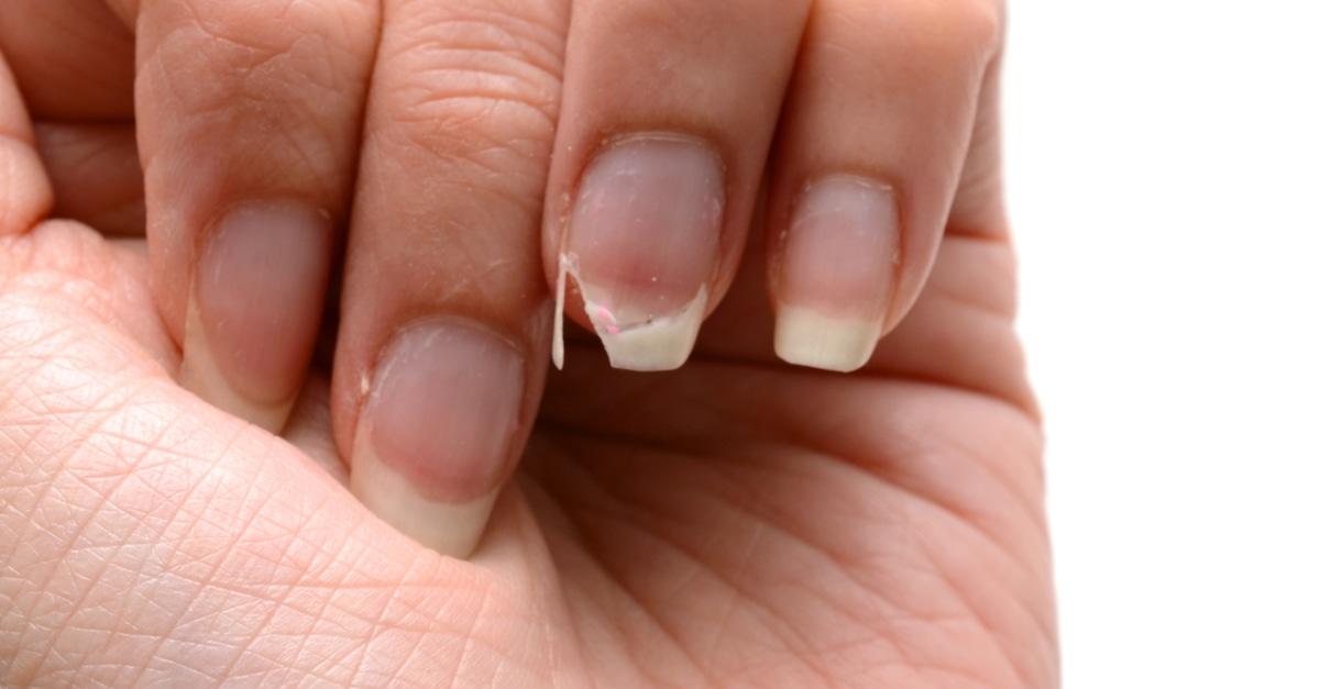 نصائح مهمة للوقاية من تشقق الأظافر