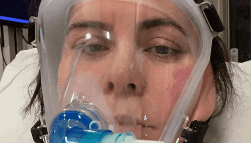 بعد غيبوبة أسابيع مريضة بكورونا تتعافى بجرعة فياغرا