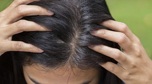 بين الطفولة والبلوغ ما أسباب تغير لون الشعر لدينا