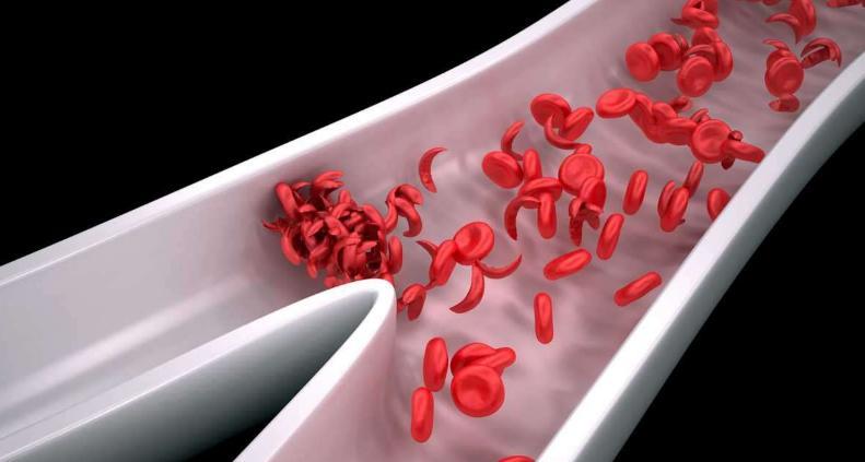 هل الرجيم يسبب فقر الدم 