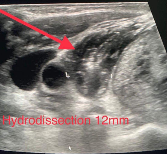 عملية نوعية بالخدمات الطبية