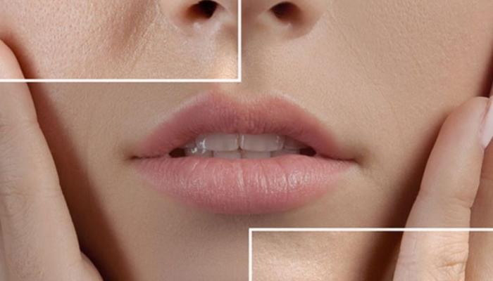 كيف تحمي بشرتك من مشكلة المسام الواسعة