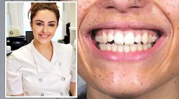  شرب الماء بعد الوجبات يساعد على تبييض الأسنان