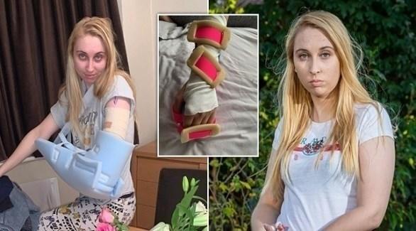  تصاب بشلل في الذراع بسبب غرسة منع الحمل