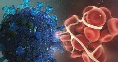 نصائح لحماية نفسك من الجلطات