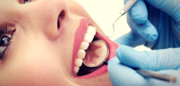 أمور غير متوقعة تؤدي لتسوس الأسنان لن تتخيلها