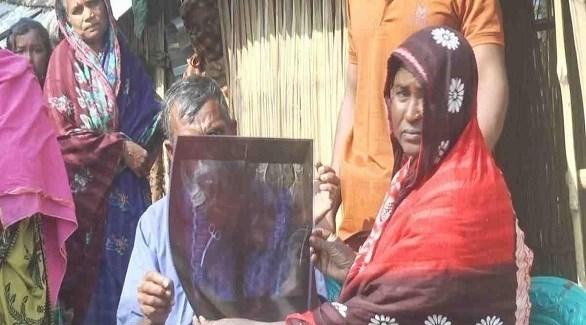  تعيش مع مقص جراحي في بطنها لمدة 20 عاماً