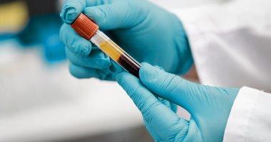 هذا التحليل يكشف عن التهاب الغدة الدرقية