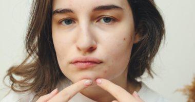 5 أمراض جلدية شائعة في الشتاء