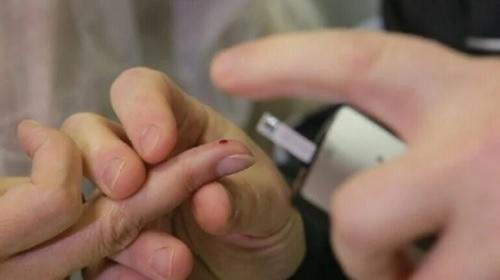 طبيب روسي يكشف أفضل وسيلة للوقاية من السكري