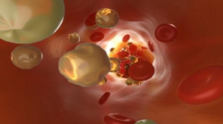 أفضل من الأدوية غذاء يخفض الكولسترول بنسبة 40