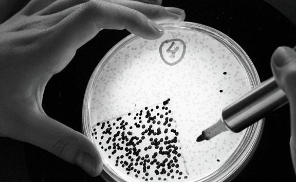 أكثر من 12 مليون وفاة نتيجة عدوى ببكتيريا في 2019