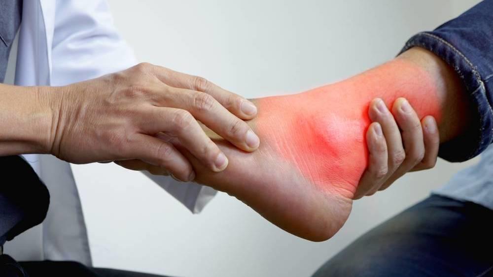 داء النقرس يصيب مفاصل الجسم تعرف عليه