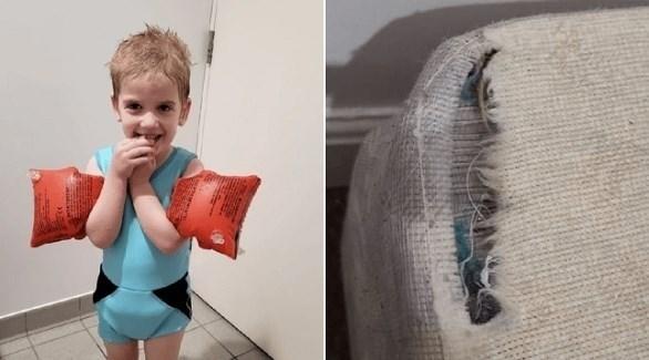 يعاني من حالة نادرة طفل يأكل مفروشات منزله