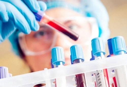 اختبار دم يكشف الإصابة بالسرطان مبكراً 