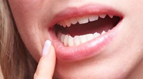  ما هو سرطان الفم 