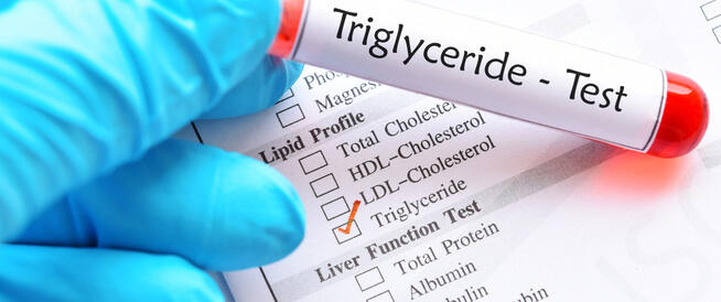 أطعمة ترفع نسبة الدهون الثلاثية الضارة تجنبها