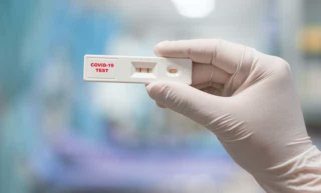 مطالب بتوفير فحص كورونا السريع في الصيدليات