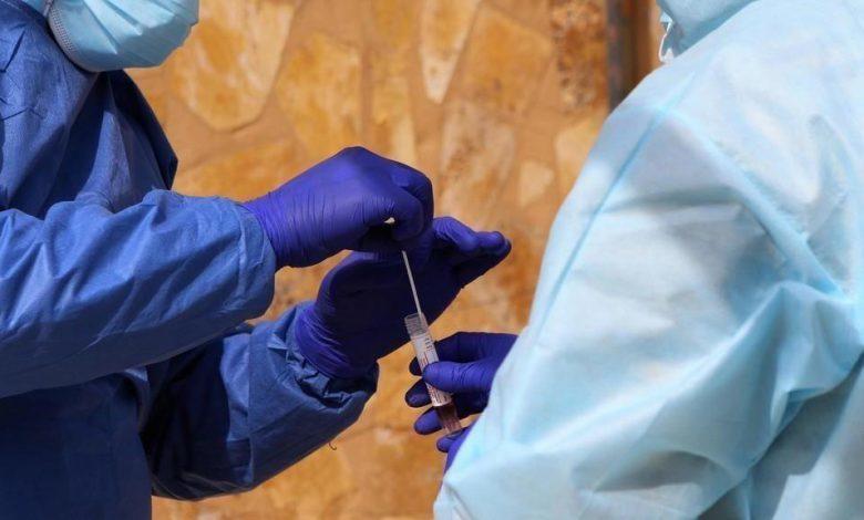 مراكز فحص كورونا العاملة طيلة الأسبوع  أسماء 