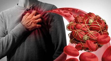  الطقس قد يزيد من خطر الإصابة بالجلطة الدموية