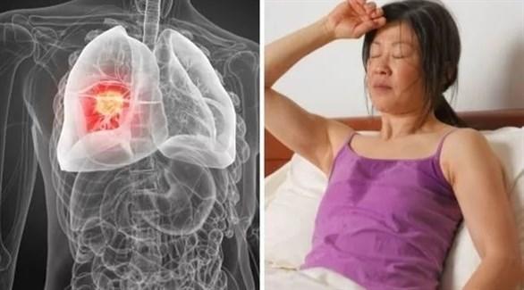  أعراض شائعة للسرطان يتجاهلها الكثيرون