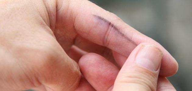 طرق مبتكرة لتنظيف اليدين من بقع الحبر