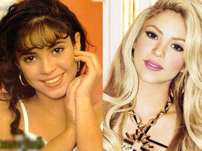 شاكيرا قبل و بعد  صور 