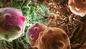 نقلة كبيرة بعلاج سرطان البنكرياس