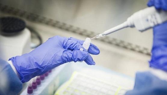 الكشف عن طريقة جديدة لفحص كورونا