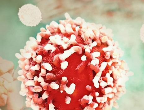 علامة تصيبك بالصباح من أعراض السرطان