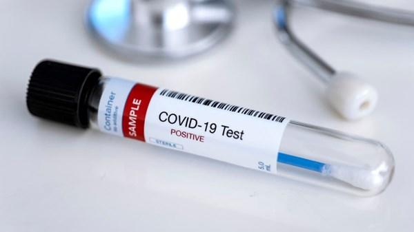 لأول مرة في العالم ثبتت إصابته بكورونا 78 مرة