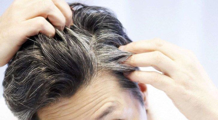 هل تعاني من الشيب المبكر إليك أسبابه