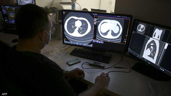 5 علامات قد تدل على إصابتك بسرطان الرئة