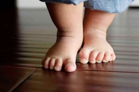 تعرق أقدام الأطفال متى يشير إلى حالة مرضية