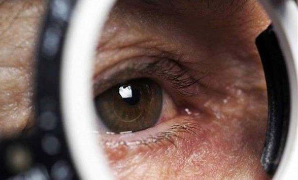 إحذر هذه العلامات تشير إلى الإصابة بسرطان العين