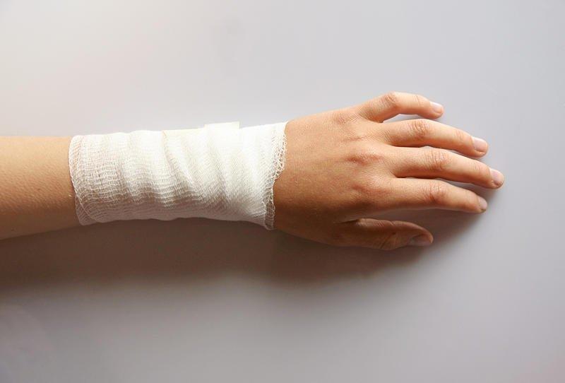 دراسة تكشف كيف يمكن لحرق بسيط أن يهدد حياتنا