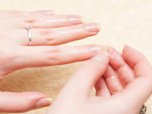 أفضل علاج لـ تكسر الأظافر