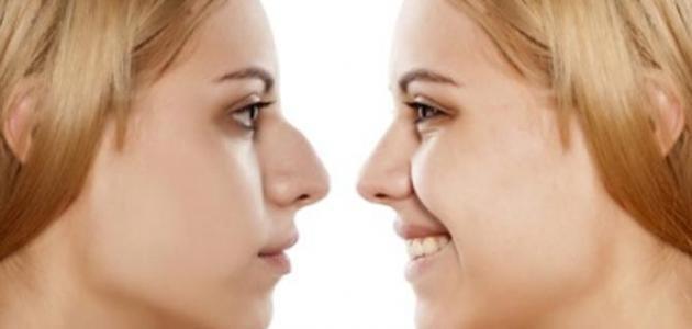 إليكم أضرار عمليات التجميل