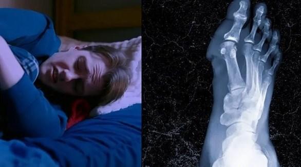  بتر أصابع وقدمي طالب بسبب بقايا طعام 