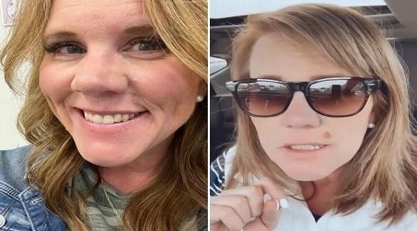  تكتشف أن وحمة على وجهها سرطان جلد