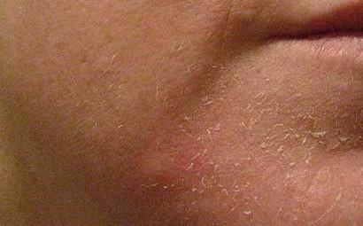 نصائح وطرق طبيعية لتنظيف البشرة الجافة