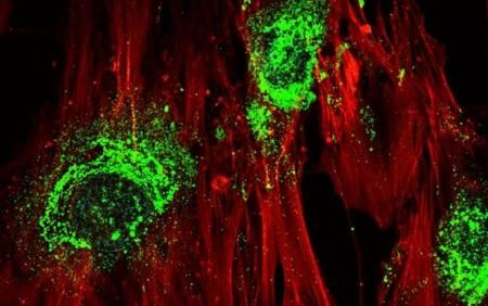 اكتشاف طريقة لتحويل الخلايا الجذعية إلى عظام