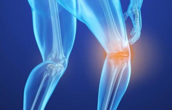 4 أطعمة تحميك من الكسور