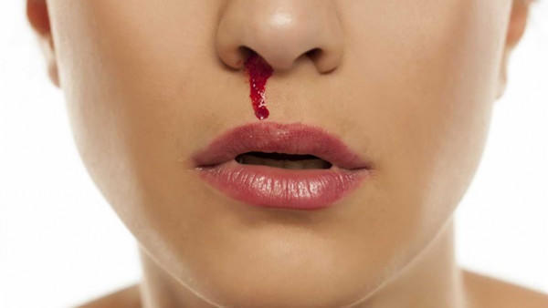 أسباب نزيف الأنف بالشتاء وطرق العلاج