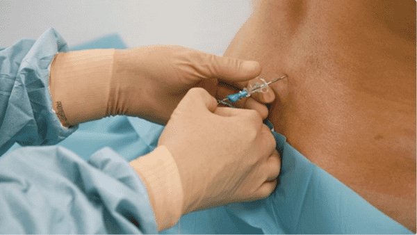 العلاقة بين التخدير أسفل العمود الفقري ومرض التوحد