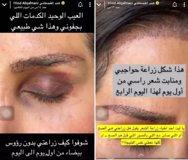 هند القحطاني: أستحي منكم لكن ضروري أوريكم!