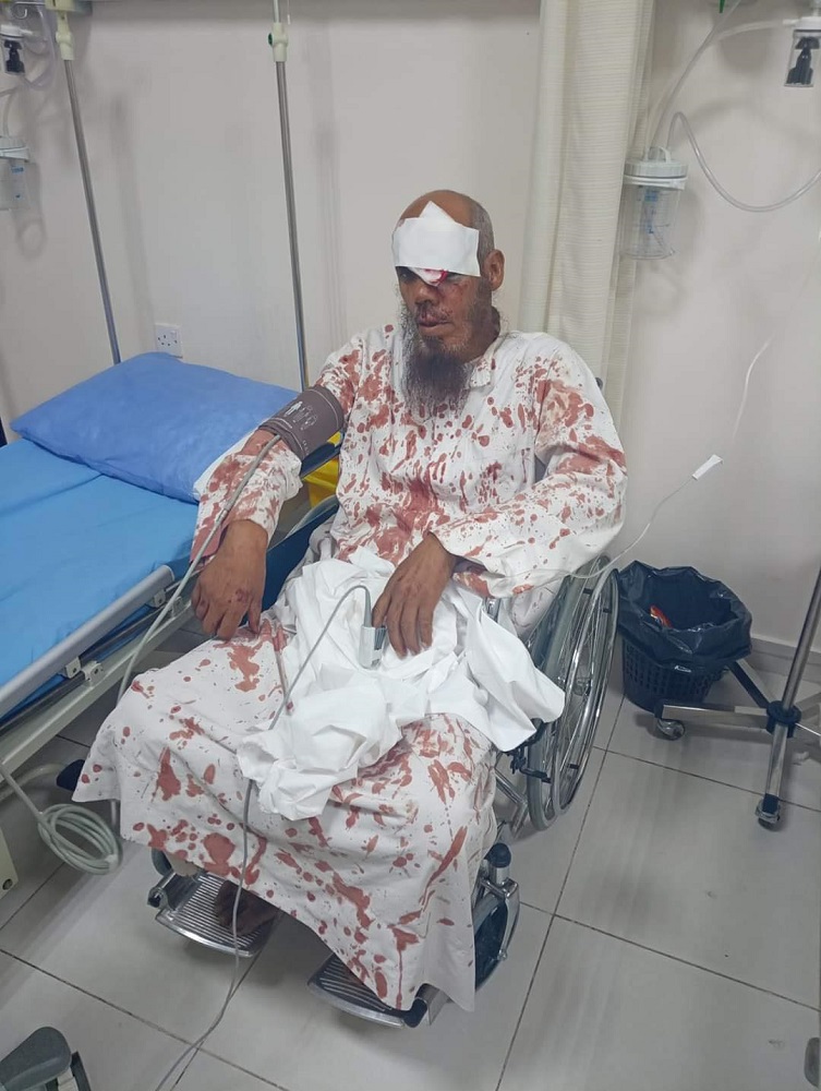 اعتداء وحشي بالضرب على ستيني أردني - صورة 