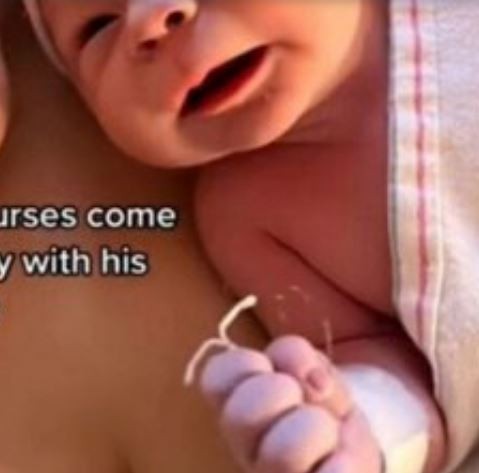 وضعت لولبا لمنع الحمل.. فأنجبت طفلا يحمله في يده - صورة 