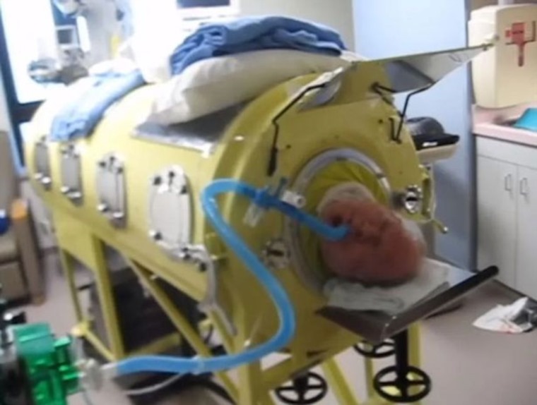 يعيش 70 عاماً داخل جهاز الرئة الحديدية بعدما أصيب بالشلل